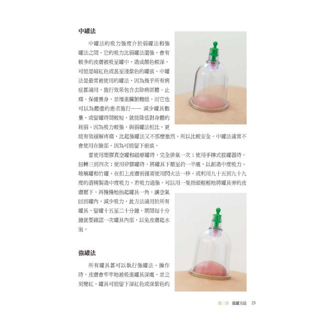 拔罐治療完全手冊:徹底消除肌肉與關節的疼痛 拔罐治療完全手冊:徹底消除肌肉與關節的疼痛