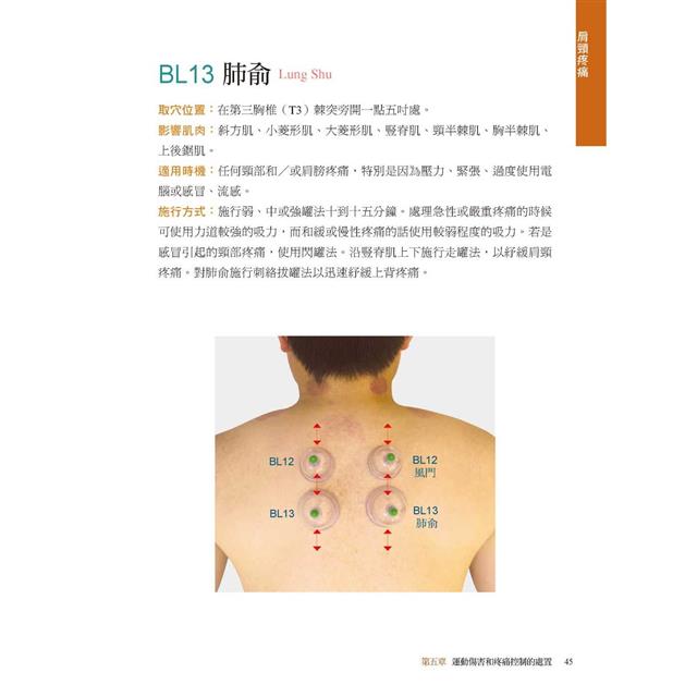 拔罐治療完全手冊:徹底消除肌肉與關節的疼痛 拔罐治療完全手冊:徹底消除肌肉與關節的疼痛
