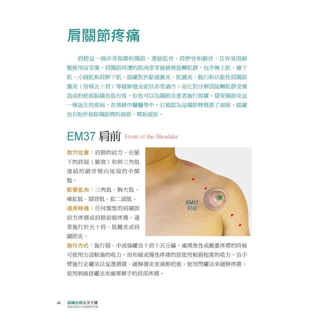 拔罐治療完全手冊:徹底消除肌肉與關節的疼痛 拔罐治療完全手冊:徹底消除肌肉與關節的疼痛