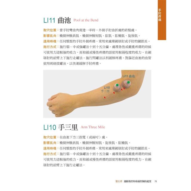 拔罐治療完全手冊:徹底消除肌肉與關節的疼痛 拔罐治療完全手冊:徹底消除肌肉與關節的疼痛