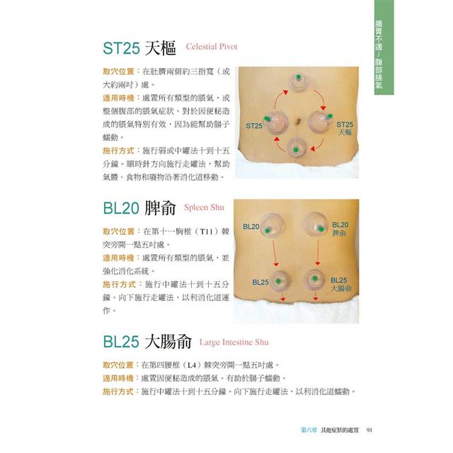 拔罐治療完全手冊:徹底消除肌肉與關節的疼痛 拔罐治療完全手冊:徹底消除肌肉與關節的疼痛