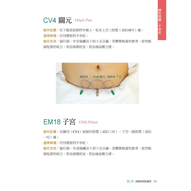 拔罐治療完全手冊:徹底消除肌肉與關節的疼痛 拔罐治療完全手冊:徹底消除肌肉與關節的疼痛