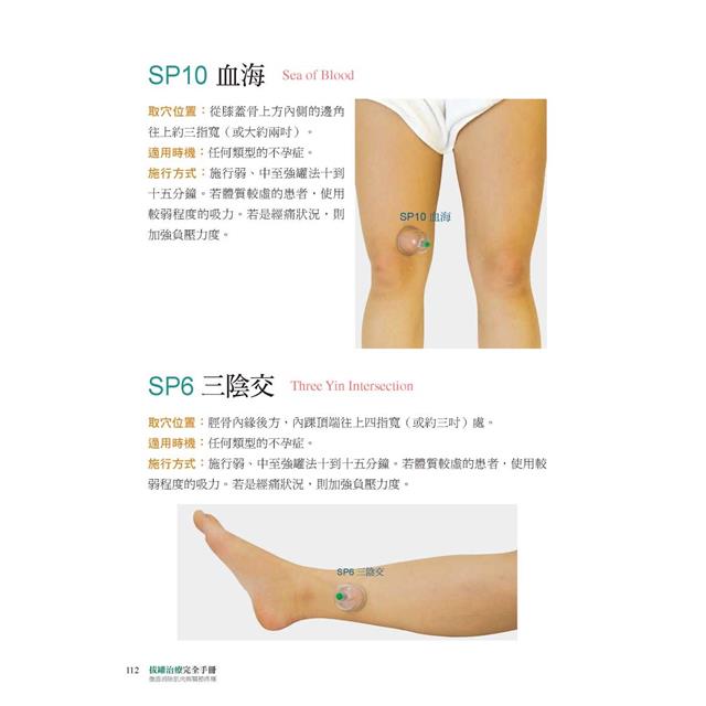 拔罐治療完全手冊:徹底消除肌肉與關節的疼痛 拔罐治療完全手冊:徹底消除肌肉與關節的疼痛