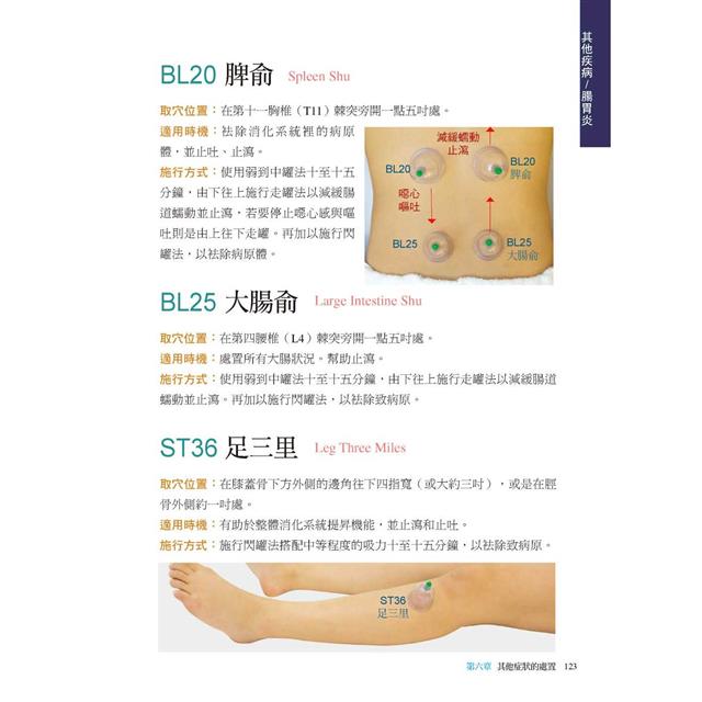 拔罐治療完全手冊:徹底消除肌肉與關節的疼痛 拔罐治療完全手冊:徹底消除肌肉與關節的疼痛