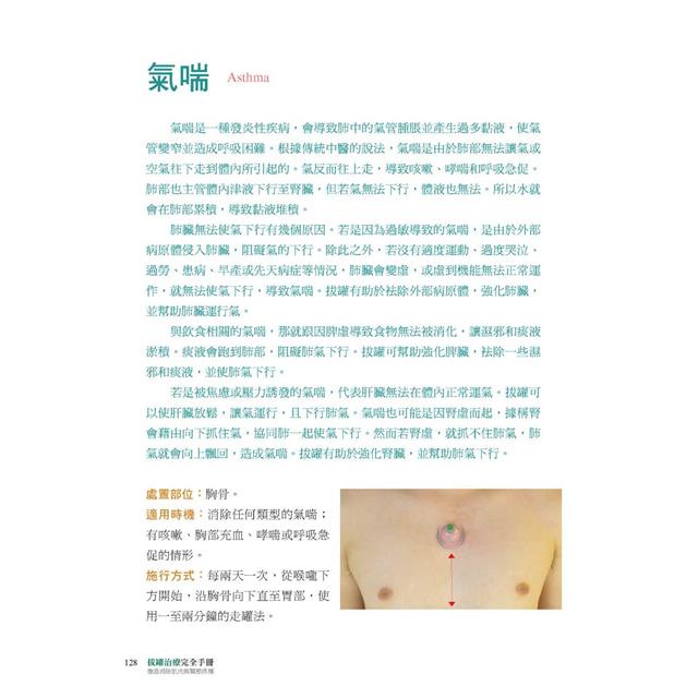 拔罐治療完全手冊:徹底消除肌肉與關節的疼痛 拔罐治療完全手冊:徹底消除肌肉與關節的疼痛