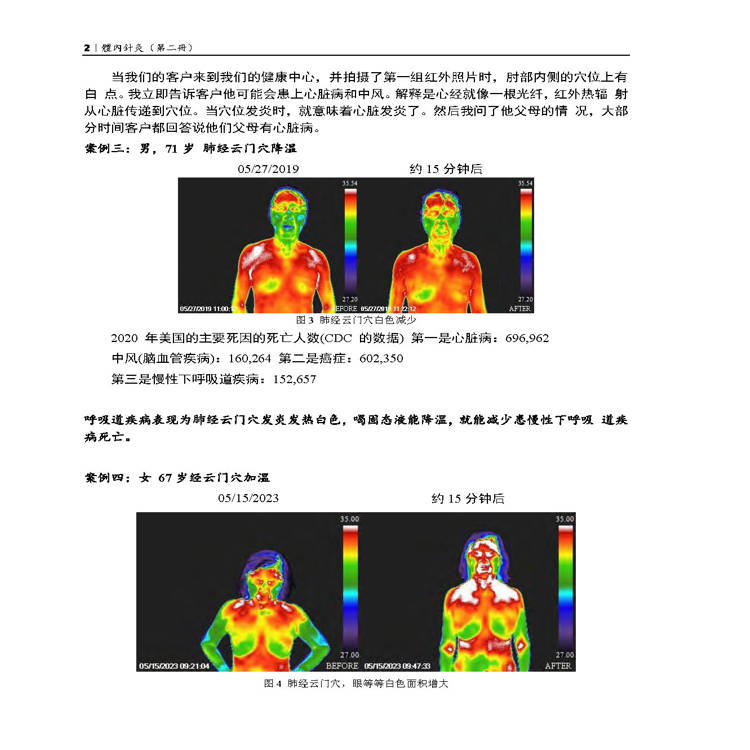 體內針灸(第二冊) 體內針灸(第二冊)