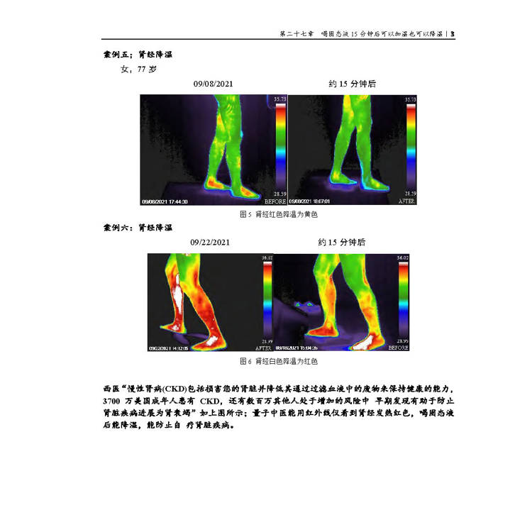 體內針灸(第二冊) 體內針灸(第二冊)