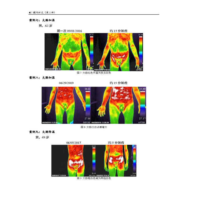體內針灸(第二冊) 體內針灸(第二冊)