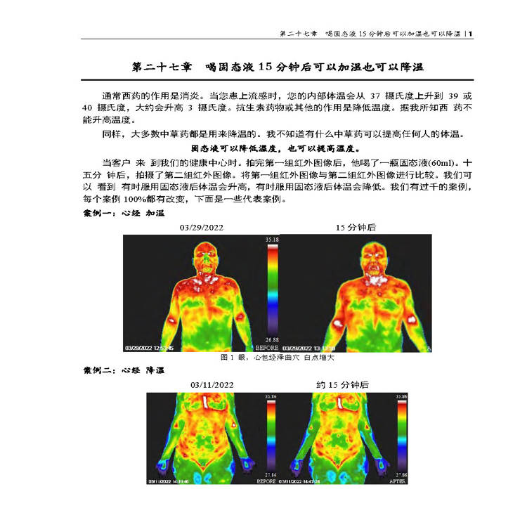 體內針灸(第二冊) 體內針灸(第二冊)