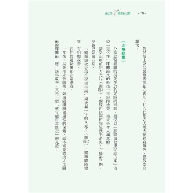 自己的膝蓋自己救:退化性膝關節炎的真相【暢銷增訂版】 自己的膝蓋自己救:退化性膝關節炎的真相【暢銷增訂版】