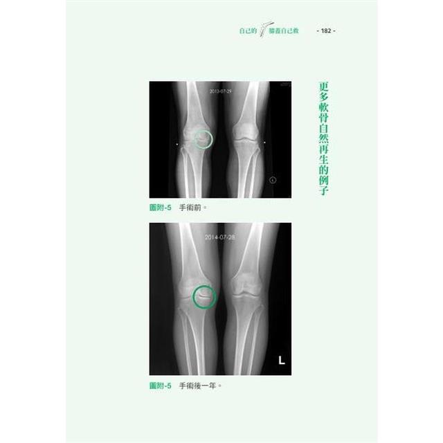 自己的膝蓋自己救:退化性膝關節炎的真相【暢銷增訂版】 自己的膝蓋自己救:退化性膝關節炎的真相【暢銷增訂版】