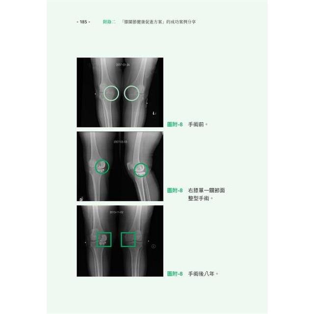 自己的膝蓋自己救:退化性膝關節炎的真相【暢銷增訂版】 自己的膝蓋自己救:退化性膝關節炎的真相【暢銷增訂版】