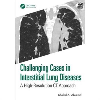 Challenging Cases in Interstitial Lung Diseases