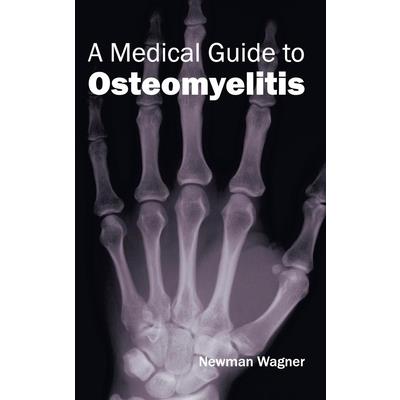 Medical Guide to Osteomyelitis