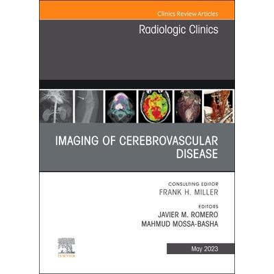 Imaging of Cerebrovascular Disease, an Issue of Radiologic Clinics of North America