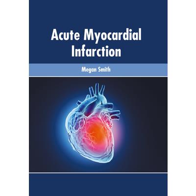 Acute Myocardial Infarction