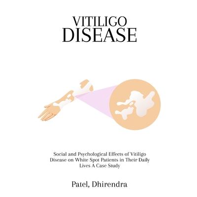Social and Psychological Effects of Vitiligo Disease on White Spot Patients in Their Daily Lives A Case Study