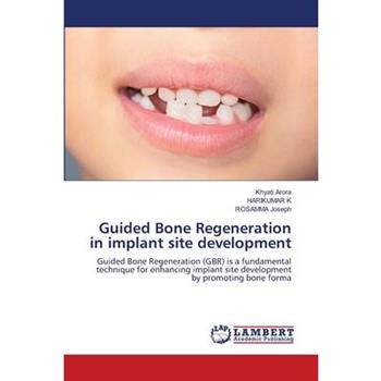 Guided Bone Regeneration in implant site development