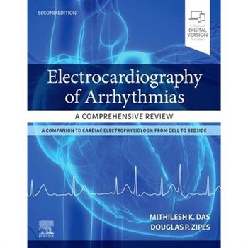 Electrocardiography of Arrhythmias: A Comprehensive Review