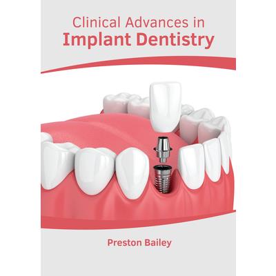 Clinical Advances in Implant Dentistry