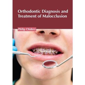 Orthodontic Diagnosis and Treatment of Malocclusion