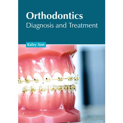 Orthodontics: Diagnosis and Treatment