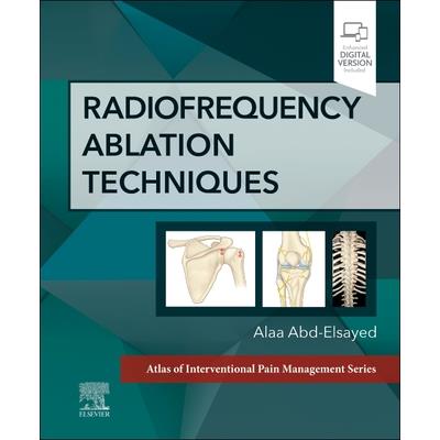 Radiofrequency Ablation Techniques