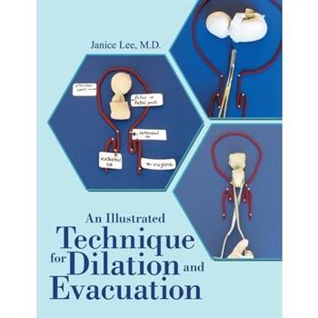 An Illustrated Technique for Dilation and Evacuation