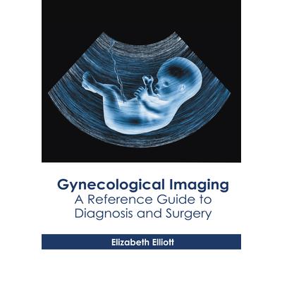 Gynecological Imaging: A Reference Guide to Diagnosis and Surgery