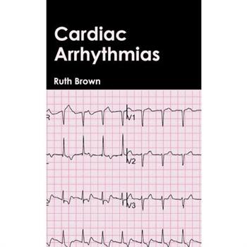 Cardiac Arrhythmias