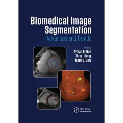 Biomedical Image SegmentationAdvances and Trends