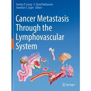 Cancer Metastasis Through the Lymphovascular System