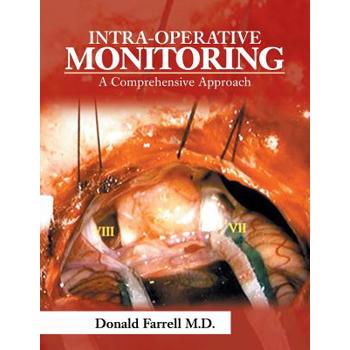 Intra-operative Monitoring