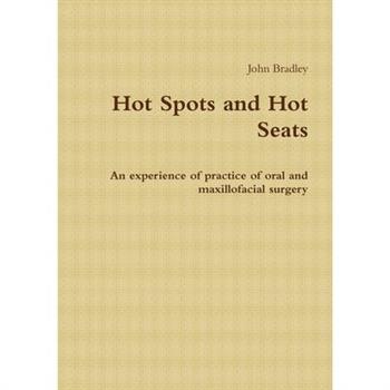 Hot Spots and Hot Seats