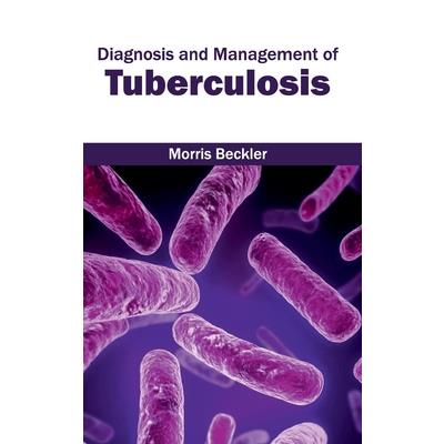 Diagnosis and Management of Tuberculosis
