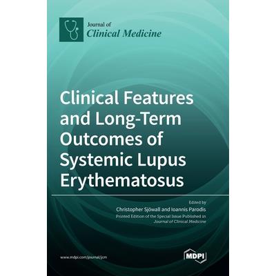 Clinical Features and Long-Term Outcomes of Systemic Lupus Erythematosus