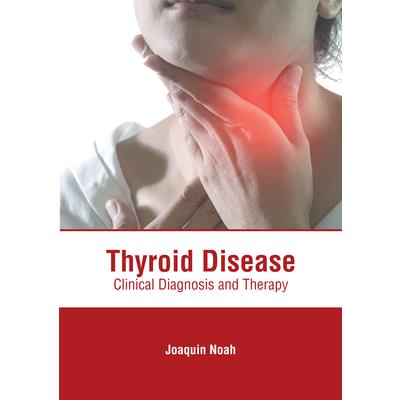 Thyroid Disease: Clinical Diagnosis and Therapy
