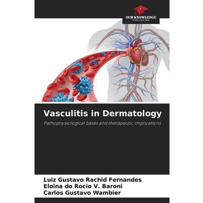 Vasculitis in Dermatology