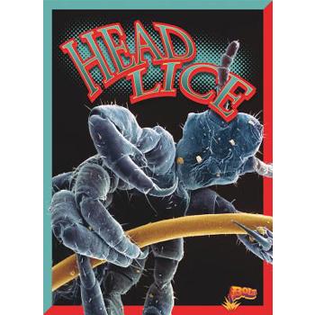Head Lice