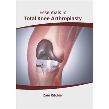 Essentials in Total Knee Arthroplasty