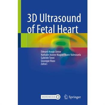 3D Ultrasound of Fetal Heart