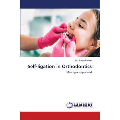 Self-ligation in Orthodontics