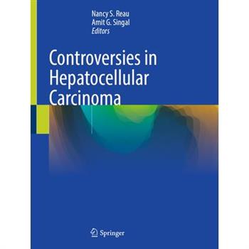 Controversies in Hepatocellular Carcinoma