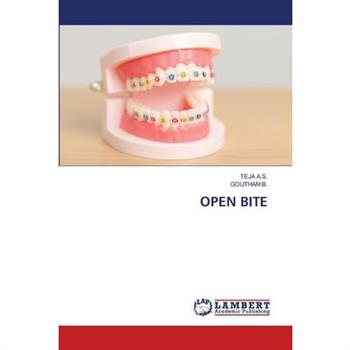 Open Bite