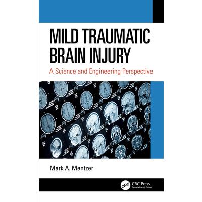 Mild Traumatic Brain Injury