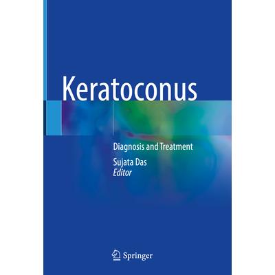 Keratoconus