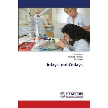 Inlays and Onlays