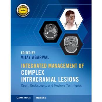 Integrated Management of Complex Intracranial Lesions Hardback Set and Static Online Product