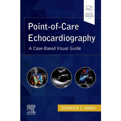 Point-Of-Care Echocardiography