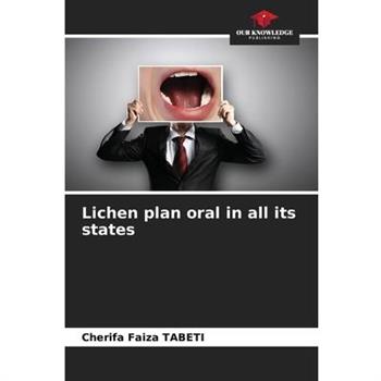Lichen plan oral in all its states
